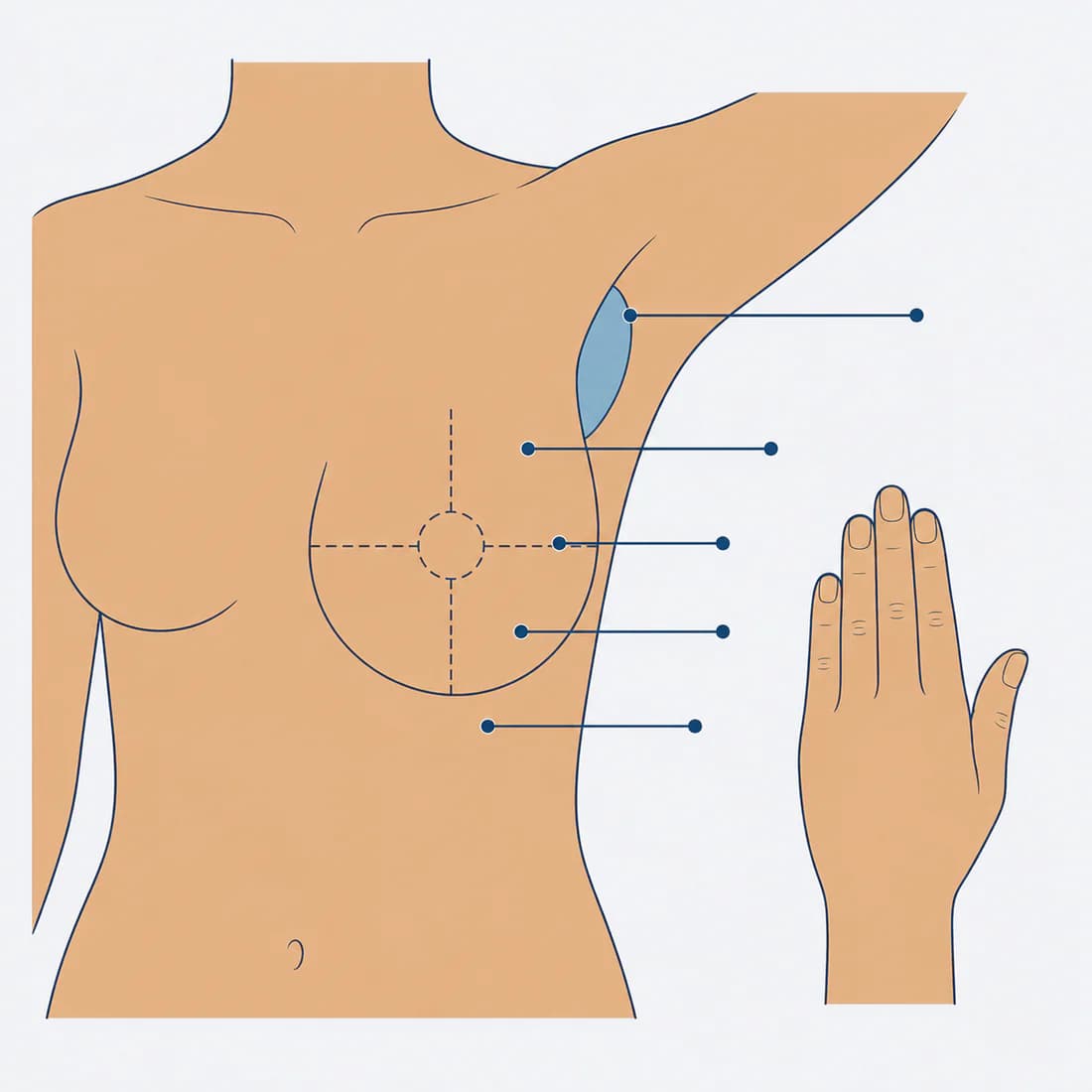 A drawing of the chest and armpit, with lines marking the four quarters of the breast and the area under the arm, and a hand held flat beside it showing how to feel.