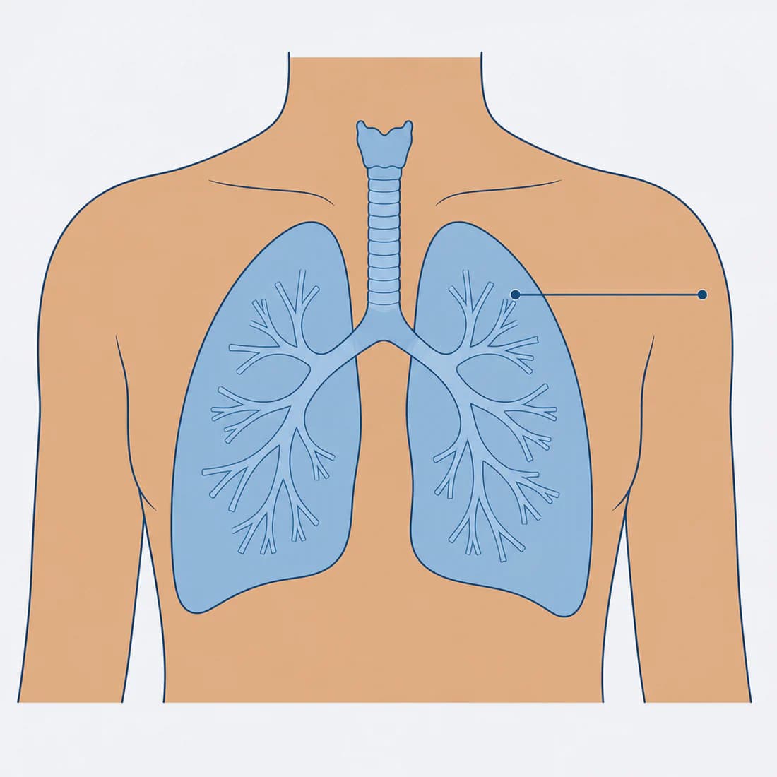 A drawing of the chest showing the windpipe, both lungs and the airways branching through them, with a line pointing to the upper part of one lung.